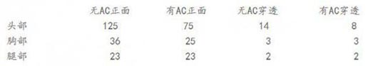 CF穿越火线冲锋枪UMP45值不值得入手?UMP45评测