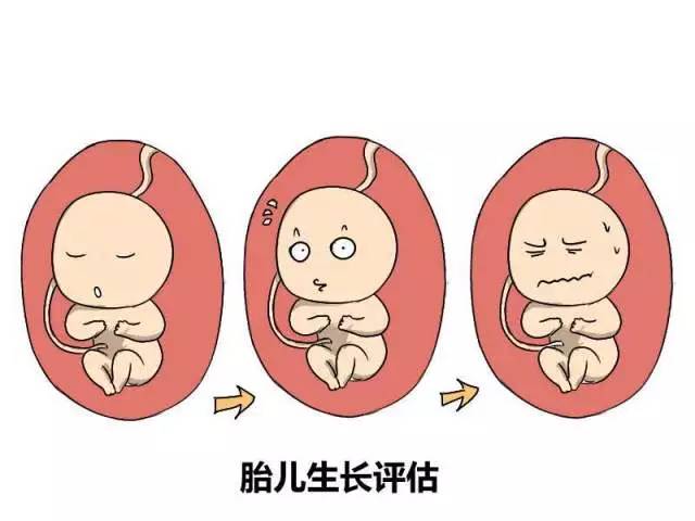sd是什么意思