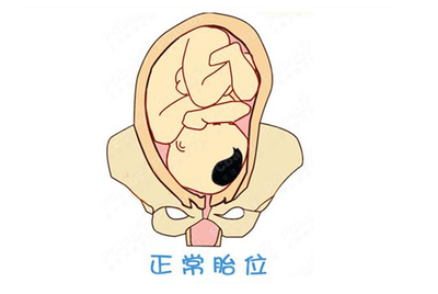 胎位roa是什么意思